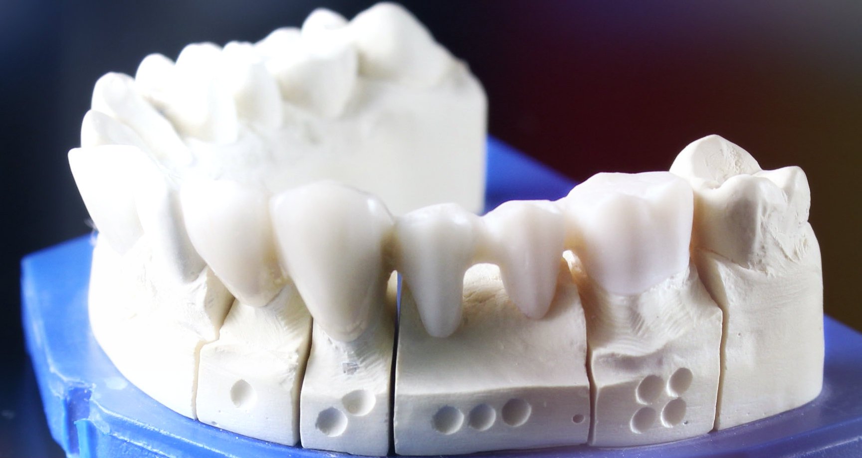 3d-systems-dental-services